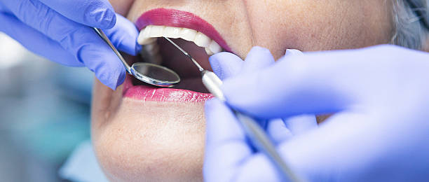 Best Walk-In Emergency Dental Services in Webster, SD